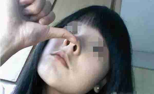 10个你最关心的隆鼻问答