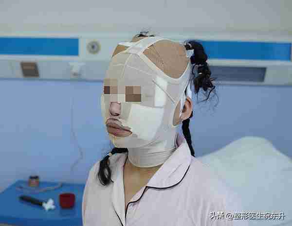 62岁到北京把拉皮手术做了，15天后忍不住吐槽这“3件事”!
