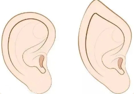 耳廓再造术要等多长手术时间